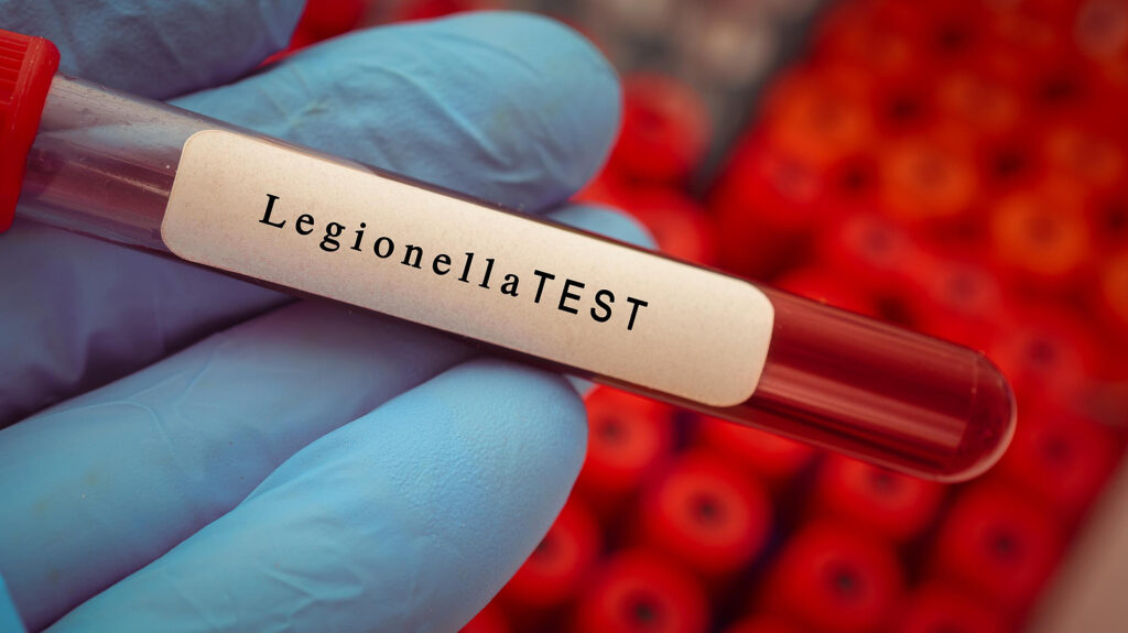 photo of a test tube for legionella