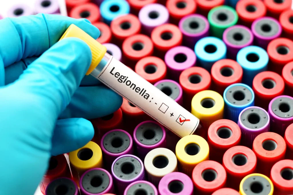 Legionella vial sample with positive marking
